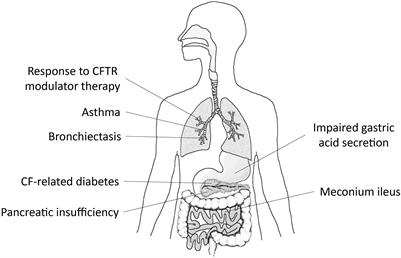 Role of the SLC26A9 Chloride Channel as Disease Modifier and Potential Therapeutic Target in Cystic Fibrosis